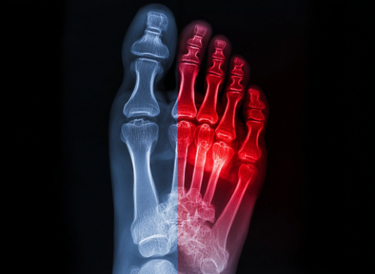 TUFFTARSAL® Metatarsal Protection: The Invisible Armor for High-Risk Workplaces